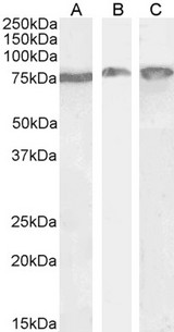 HSPA5 / GRP78 / BiP Antibody - HSPA5 / GRP78 / BiP antibody (0.3µg/ml) staining of Mouse Liver (A) and Testes (B) and (0.5ug/ml) Rat Brain (C) lysate (35µg protein in RIPA buffer). Detected by chemiluminescence.