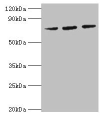 HSPA6 / HSP70B' Antibody - Western blot All lanes: HSPA6 antibody at 2µg/ml Lane 1: MCF-7 whole cell lysate Lane 2: A431 whole cell lysate Lane 3: Jurkat whole cell lysate Secondary Goat polyclonal to rabbit IgG at 1/10000 dilution Predicted band size: 72 kDa Observed band size: 72 kDa