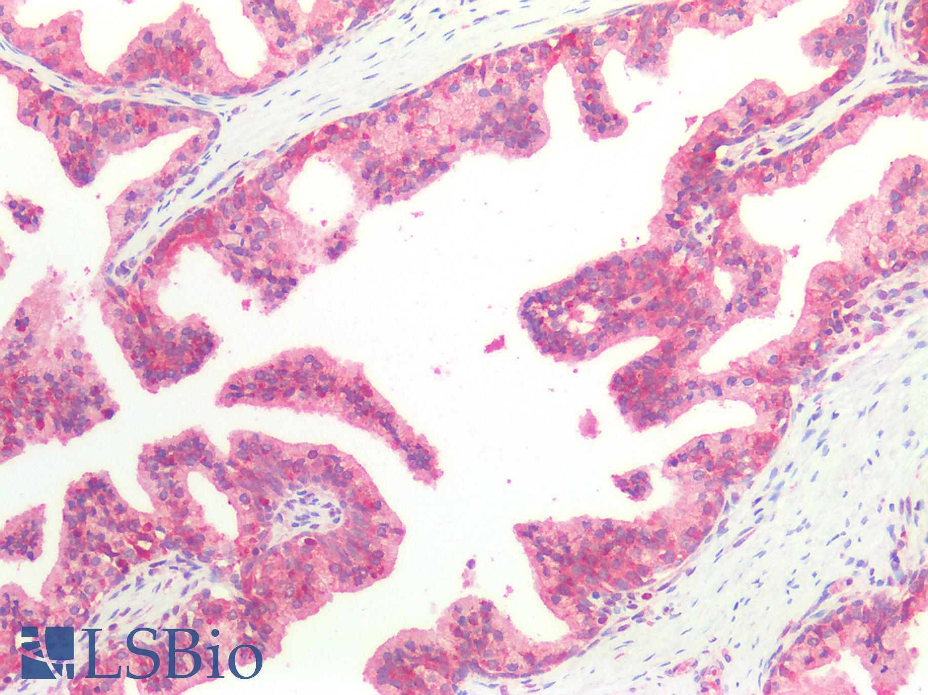 HSPA8 / HSC70 Antibody - Human Prostate: Formalin-Fixed, Paraffin-Embedded (FFPE)