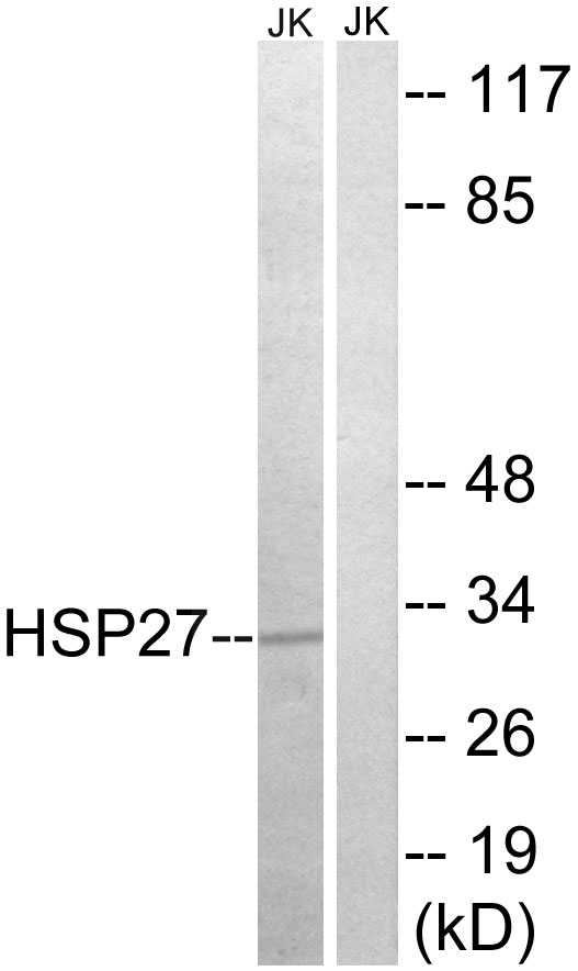 HSPB1 / HSP27 Antibody - Western blot analysis of lysates from Jurkat cells, treated with Ca2+, using HSP27 Antibody. The lane on the right is blocked with the synthesized peptide.