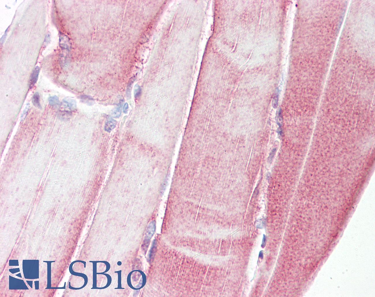 HSPB1 / HSP27 Antibody - Anti-HSPB1 antibody IHC of human skeletal muscle. Immunohistochemistry of formalin-fixed, paraffin-embedded tissue after heat-induced antigen retrieval. Antibody dilution 1:100.