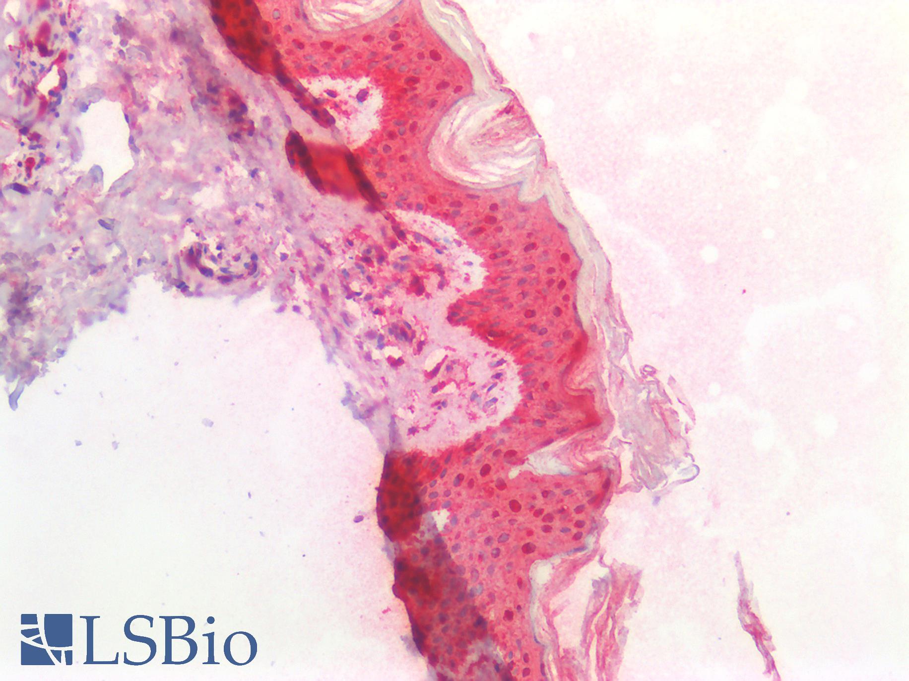 HSPB1 / HSP27 Antibody - Human Skin: Formalin-Fixed, Paraffin-Embedded (FFPE)