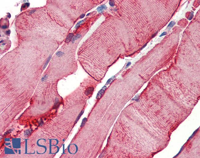 HSPB1 / HSP27 Antibody - Anti-HSP27 / Heat Shock Protein 27 antibody IHC of human skeletal muscle. Immunohistochemistry of formalin-fixed, paraffin-embedded tissue after heat-induced antigen retrieval. Antibody concentration 10 ug/ml.