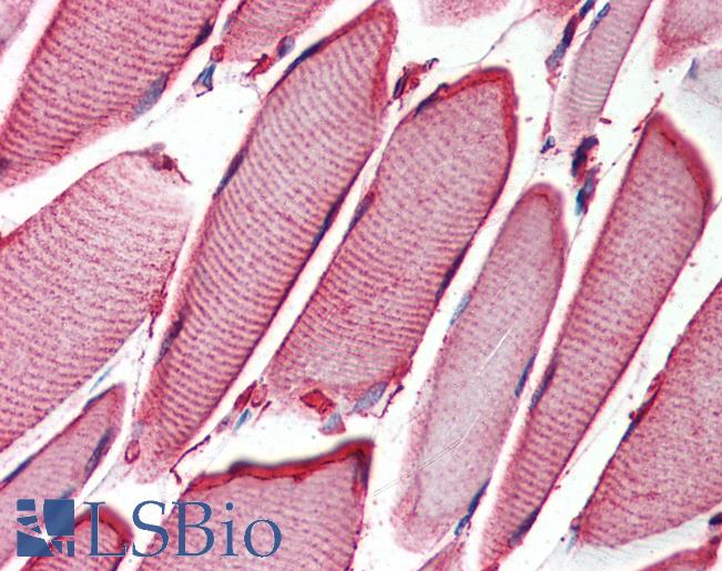 HSPB6 / HSP20 Antibody - Anti-HSPB6 antibody IHC of human skeletal muscle. Immunohistochemistry of formalin-fixed, paraffin-embedded tissue after heat-induced antigen retrieval. Antibody concentration 5 ug/ml.