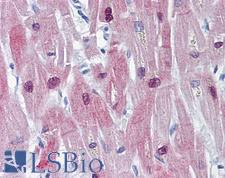 HSPB6 / HSP20 Antibody - Anti-HSPB6 antibody IHC of human heart. Immunohistochemistry of formalin-fixed, paraffin-embedded tissue after heat-induced antigen retrieval. Antibody concentration 10 ug/ml.