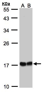HSPB8 / H11 / HSP22 Antibody - Sample (30 ug whole cell lysate). A:293T whole cell lysate, B: A431. 12% SDS PAGE. HSPB8 / H11 / HSP22 antibody diluted at 1:1000