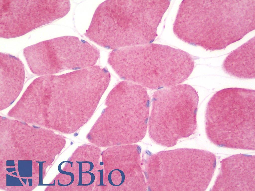 HSPB8 / H11 / HSP22 Antibody - Anti-HSPB8 / H11 / HSP22 antibody IHC staining of human skeletal muscle. Immunohistochemistry of formalin-fixed, paraffin-embedded tissue after heat-induced antigen retrieval. Antibody concentration 5 ug/ml.