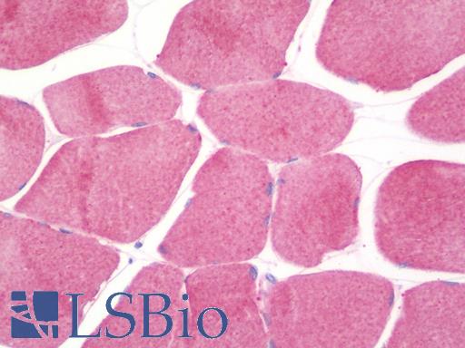 HSPB8 / H11 / HSP22 Antibody - Anti-HSPB8 / H11 / HSP22 antibody IHC staining of human skeletal muscle. Immunohistochemistry of formalin-fixed, paraffin-embedded tissue after heat-induced antigen retrieval. Antibody concentration 5 ug/ml.