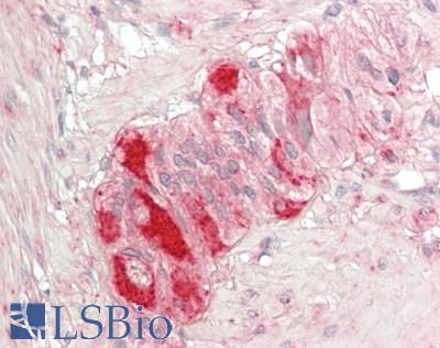 HSPD1 / HSP60 Antibody - Human Small Intestine, Myenteric Plexus: Formalin-Fixed, Paraffin-Embedded (FFPE)