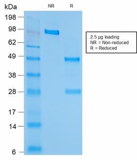 HSPD1 / HSP60 Antibody - SDS-PAGE Analysis Purified HSP60 Mouse Recombinant Monoclonal Antibody (rGROEL/780). Confirmation of Purity and Integrity of Antibody.