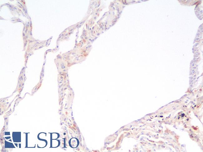 HSPD1 / HSP60 Antibody - Human Lung, Negative Control Tissue: Formalin-Fixed, Paraffin-Embedded (FFPE)