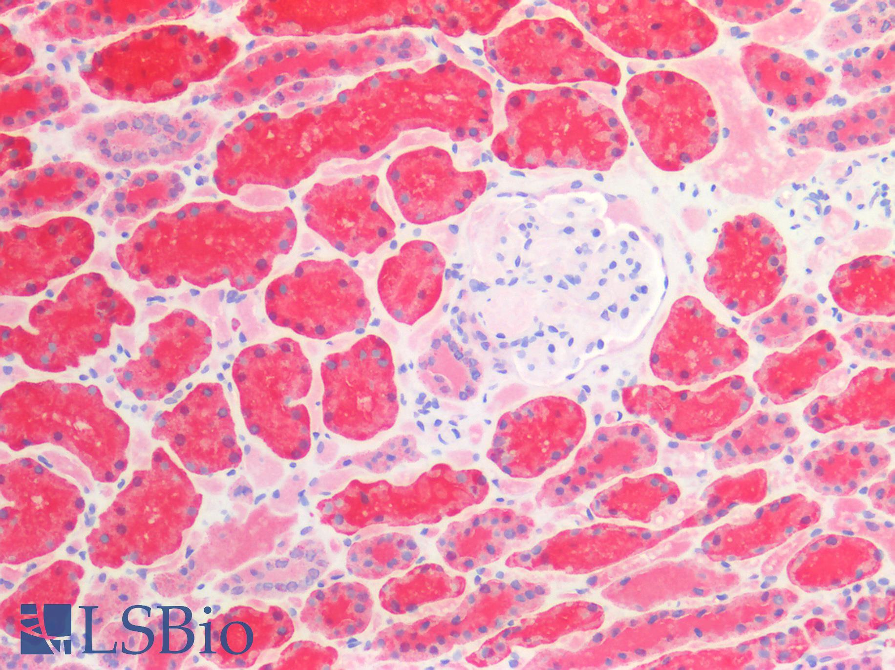 HSPD1 / HSP60 Antibody - Human Kidney: Formalin-Fixed, Paraffin-Embedded (FFPE)