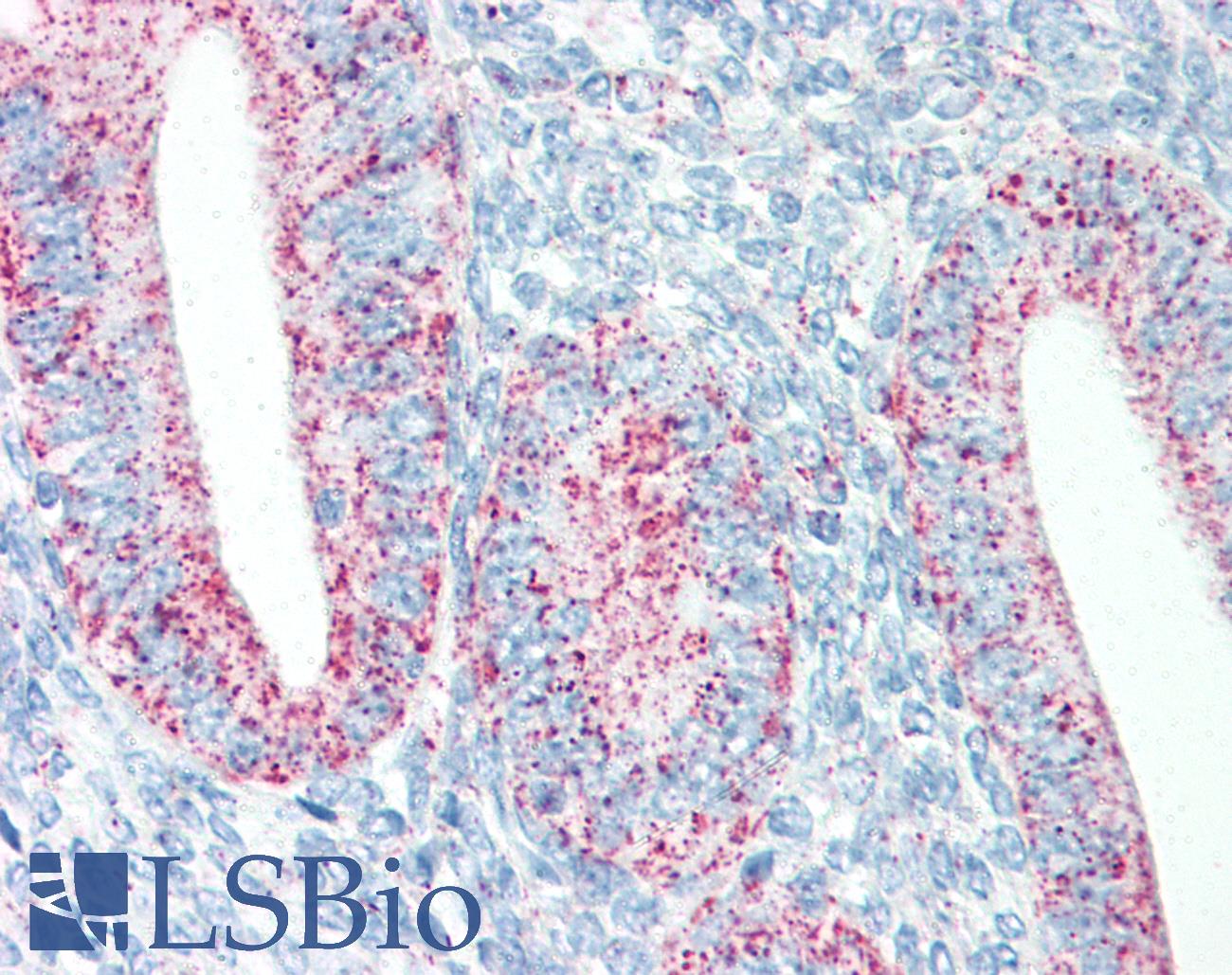 HSPD1 / HSP60 Antibody - Anti-HSPD1 antibody IHC staining of human uterus, endometrium. Immunohistochemistry of formalin-fixed, paraffin-embedded tissue after heat-induced antigen retrieval. Antibody concentration 5 ug/ml.