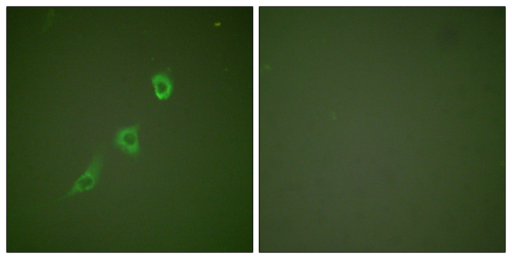 HSPE1 / HSP10 / Chaperonin 10 Antibody - Immunofluorescence analysis of NIH/3T3 cells, using HSP10 Antibody. The picture on the right is blocked with the synthesized peptide.