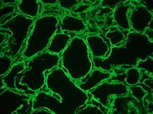 HSPG2 / Perlecan Antibody - Immunohistochemistry on frozen section of Human kidney showing strong reactivity in the extracellular matrix and basement membrane.