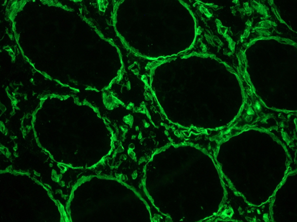 HSPG2 / Perlecan Antibody - Immunohistochemistry with HSPG2 / Perlecan on a frozen section of human colon showing strong reactivity in the extracellular matrix and basement membrane