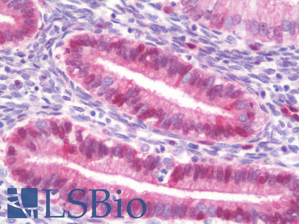 HSPH1 / HSP105 Antibody - Anti-HSPH1 / HSP110 antibody IHC staining of human uterus, endometrium. Immunohistochemistry of formalin-fixed, paraffin-embedded tissue after heat-induced antigen retrieval. Antibody dilution 1:100.