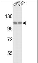 HSPH1 / HSP105 Antibody - Western blot of HSPH1 Antibody in A2058 and A375 cell line lysates (35 ug/lane). HSPH1 (arrow) was detected using the purified antibody.