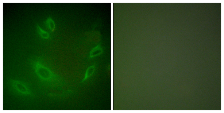 HSPH1 / HSP105 Antibody - Immunofluorescence analysis of HeLa cells, using HSP105 Antibody. The picture on the right is blocked with the synthesized peptide.