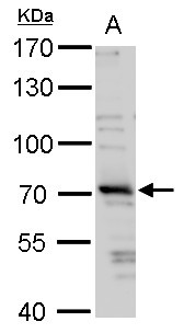 HT2A / TRIM32 Antibody - TRIM32 antibody detects TRIM32 protein by western blot analysis. A. 30 µg 293T whole cell lysate/extract 7.5 % SDS-PAGE Dilution: 1:1000