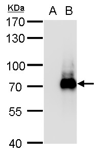 HT2A / TRIM32 Antibody - TRIM32 antibody detects TRIM32 protein by western blot analysis. A. 5 µg 293T whole cell lysate/extract B. 5 µg whole cell lysate/extract of DDDDK-human TRIM32-transfected 293T cells 7.5 % SDS-PAGE Dilution: 1:20000