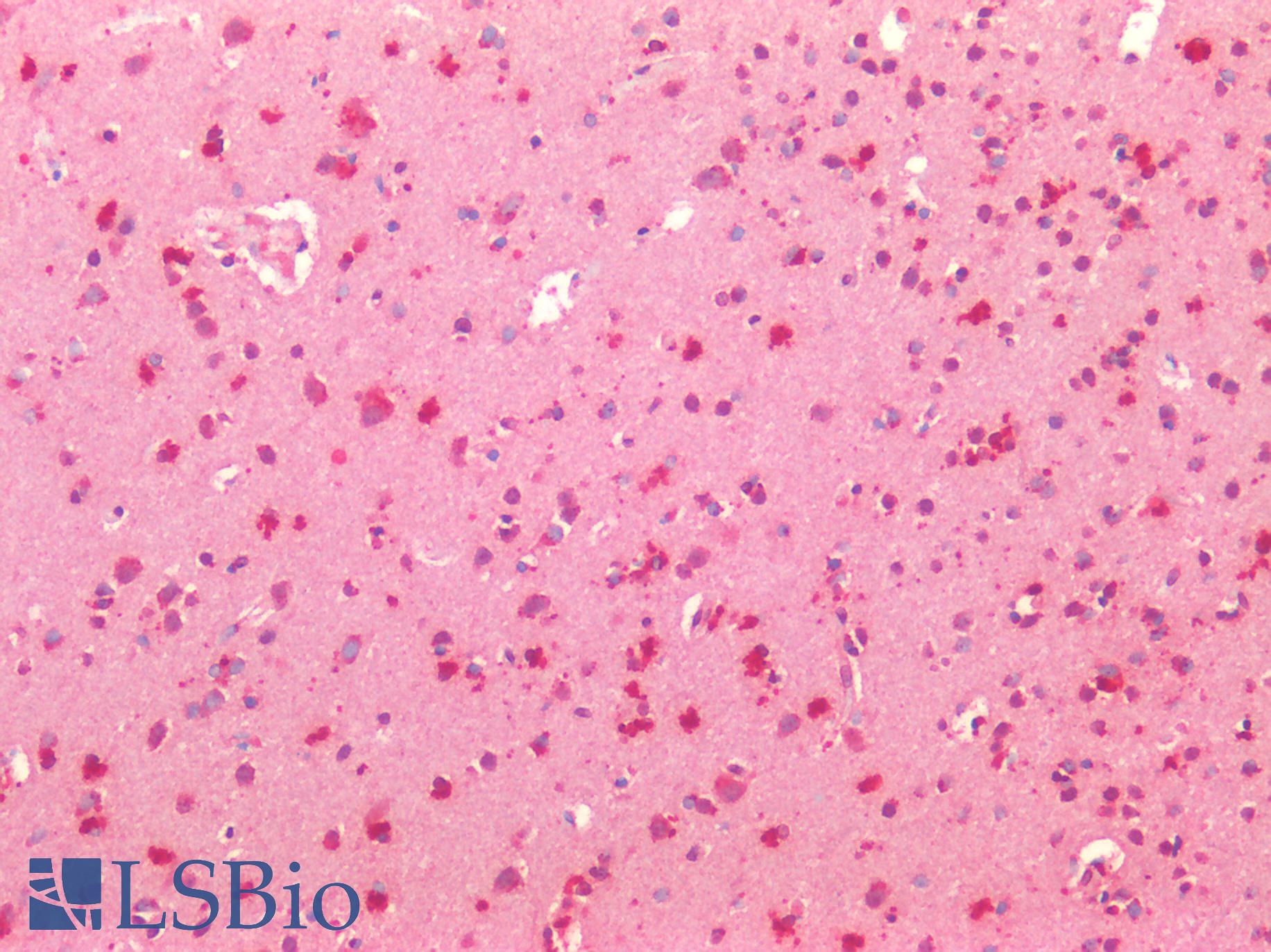 HTR1A / 5-HT1A Receptor Antibody - Human Brain, Cortex: Formalin-Fixed, Paraffin-Embedded (FFPE)