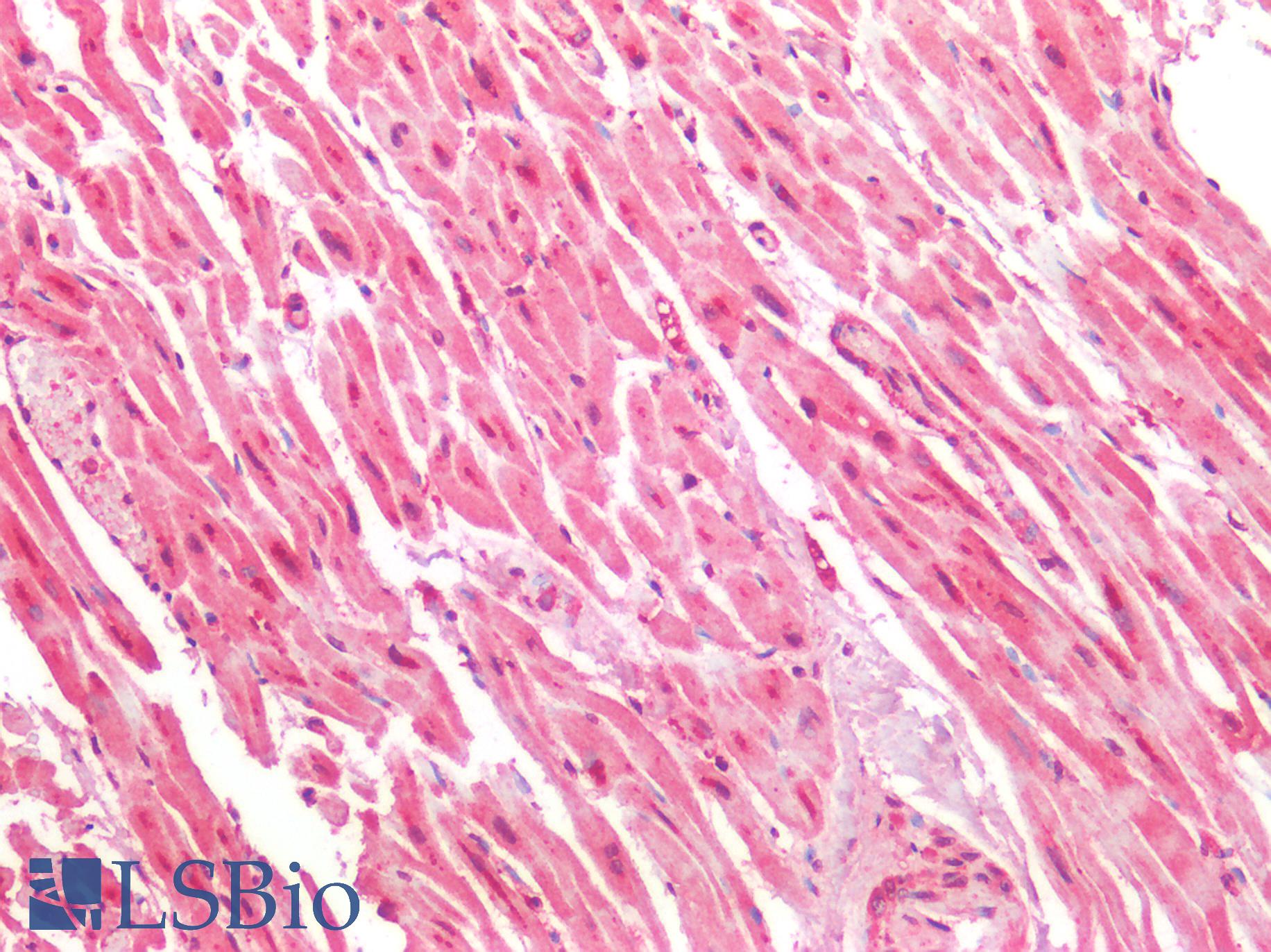 HTR1A / 5-HT1A Receptor Antibody - Human Heart: Formalin-Fixed, Paraffin-Embedded (FFPE)