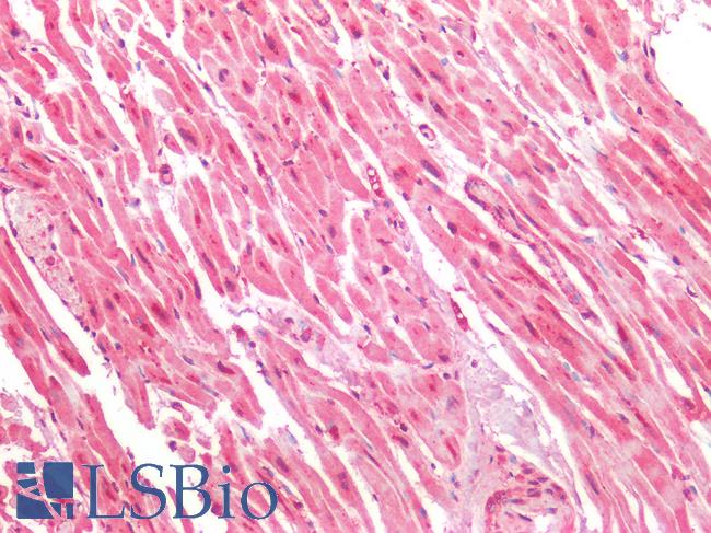 HTR1A / 5-HT1A Receptor Antibody - Human Heart: Formalin-Fixed, Paraffin-Embedded (FFPE)