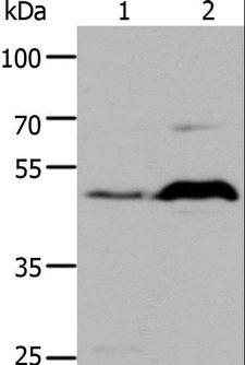 HTR1A / 5-HT1A Receptor Antibody - Western blot analysis of HepG2 cell and Mouse brain tissue, using HTR1A Polyclonal Antibody at dilution of 1:1000.