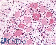 HTR1D / 5-HT1D Receptor Antibody - Anti-5HT1D Receptor antibody IHC of human spinal cord, dorsal root ganglion. Immunohistochemistry of formalin-fixed, paraffin-embedded tissue after heat-induced antigen retrieval.