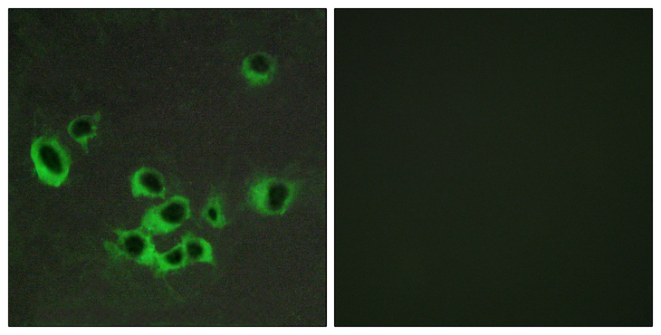 HTR2B / 5-HT2B Receptor Antibody - Immunofluorescence analysis of COS7 cells, using HTR2B Antibody. The picture on the right is blocked with the synthesized peptide.