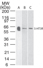 HTR3A / 5-HT3A Receptor Antibody - Western blot of 5-HT3R in human brain tissue lysate with anti-5-HT3R pcAb . A protein band of approximate molecular weight of 47-50 kDa was detected.