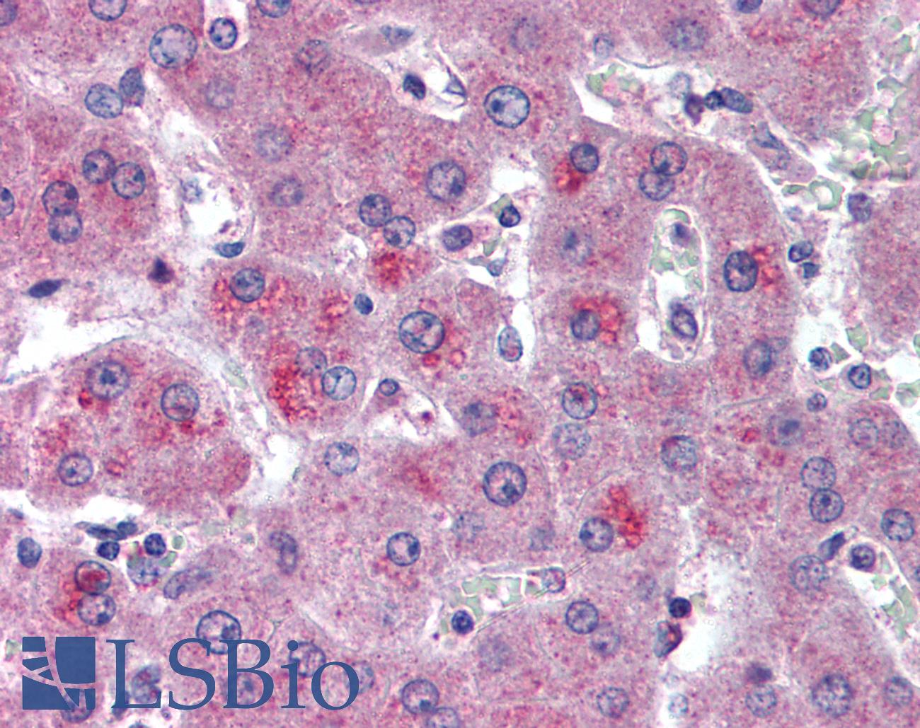 HTRA3 Antibody - Anti-HTRA3 antibody IHC of human liver. Immunohistochemistry of formalin-fixed, paraffin-embedded tissue after heat-induced antigen retrieval. Antibody concentration 10 ug/ml.