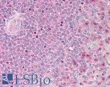 HTS1 / ST5 Antibody - Anti-ST5 antibody IHC of human spleen. Immunohistochemistry of formalin-fixed, paraffin-embedded tissue after heat-induced antigen retrieval. Antibody concentration 5 ug/ml.