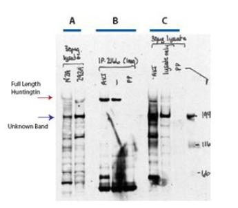 HTT / Huntingtin Antibody - Anti-Huntingtin pS421 Antibody - Western Blot. Western blot analysis after AKT and phosphatase treatment is shown using Affinity Purified anti-Huntingtin pS421 antibody. In A) untreated lysates from N2A and 293A cells were stained directly using anti-Huntingtin pS421 antibody. Full length staining of Huntingtin is noted, albeit at low levels of expression, as well as a strongly staining band at 200 kD that may represent staining of truncated protein. In B) staining is shown after immunoprecipitation using a monoclonal antibody (Mab2166) followed by AKT treatment (to phosphorylate), along with untreated, and phosphatase (PP) treated (dephosphorylate) immunoprecipitated. Full length phosphorylated huntingtin is clearly detected in these immunopurified samples (except dephosphorylated). In C) lysates are treated directly with AKT or PP to alter the phosphorylation status of Htt. Personal communication, Simon Warby, CMMT, Vancouver, BC.