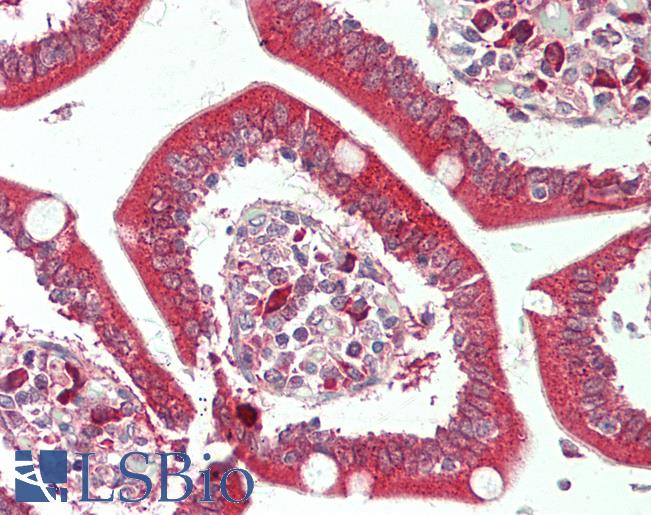 HUNK / B19 Antibody - Human Small Intestine: Formalin-Fixed, Paraffin-Embedded (FFPE)