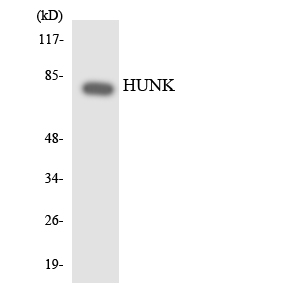HUNK / B19 Antibody - Western blot analysis of the lysates from 293 cells using HUNK antibody.