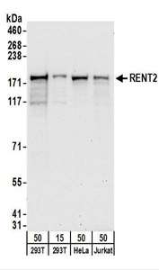 HUPF2 / UPF2 Antibody - Detection of Human RENT2 by Western Blot. Samples: Whole cell lysate from 293T (15 and 50 ug), HeLa (50 ug), and Jurkat (50 ug) cells. Antibodies: Affinity purified rabbit anti-RENT2 antibody used for WB at 0.4 ug/ml. Detection: Chemiluminescence with an exposure time of 30 seconds.