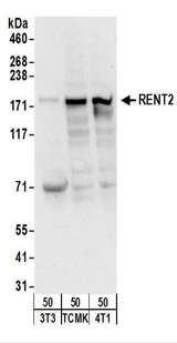 HUPF2 / UPF2 Antibody - Detection of Mouse RENT2 by Western Blot. Samples: Whole cell lysate from mouse NIH3T3 (50 ug), TCMK-1 (50 ug), and 4T1 (50 ug) cells. Antibodies: Affinity purified rabbit anti-RENT2 antibody used for WB at 1 ug/ml. Detection: Chemiluminescence with an exposure time of 10 seconds.