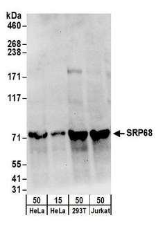 HUPF2 / UPF2 Antibody - Detection of human SRP68 by western blot. Samples: Whole cell lysate from HeLa (15 and 50 µg), HEK293T (50µg), and Jurkat (50µg) cells. Antibodies: Affinity purified rabbit anti-SRP68 antibody used for WB at 0.1 µg/ml. Detection: Chemiluminescence with an exposure time of 30 seconds.