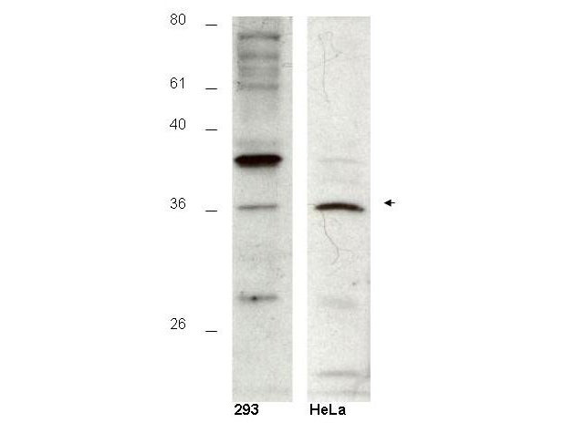 HUS1B Antibody - Anti-Hus1B Antibody - Western Blot. Western blot of affinity purified anti-Hus1B antibody shows detection of a 36kD band corresponding to Hus1B in a HeLa cell lysate (arrowhead). The staining pattern in 293 cells is less clear, showing a predominant band at 39 kD. Personal Communication, A-Lien Lu-Chang, U. Maryland, Baltimore, MD.