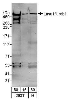 HUWE1 / ARFBP1 Antibody - Detection of Human Lasu1/Ureb1 by Western Blot. Samples: Whole cell lysate from 293T (15 and 50 ug) and HeLa (H; 50 ug) cells. Antibodies: Affinity purified goat anti-Lasu1/Ureb1 antibody used for WB at 1 ug/ml. Detection: Chemiluminescence with an exposure time of 3 minutes.