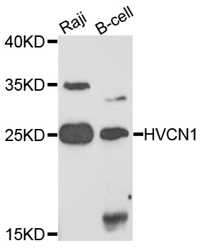 HVCN1 / HV1 Antibody - Western blot analysis of extracts of various cells.
