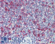 HVCN1 / HV1 Antibody - Human Spleen: Formalin-Fixed, Paraffin-Embedded (FFPE)