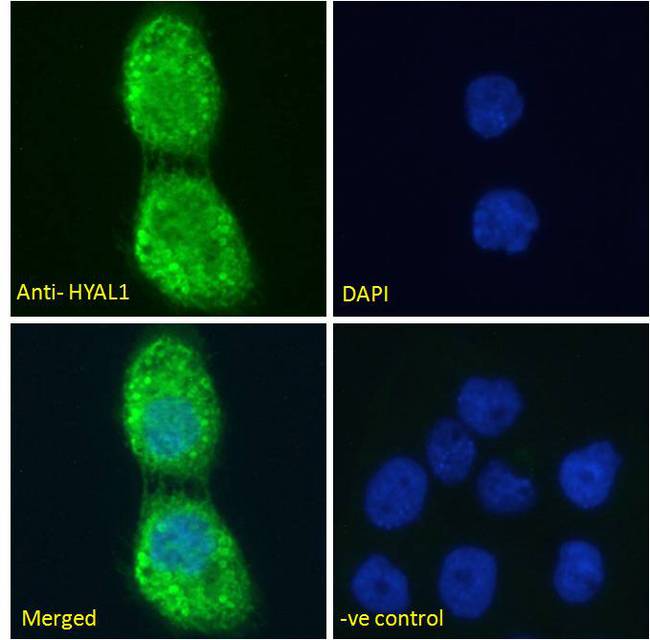 HYAL1 Antibody - Hyaluronidase 1 antibody immunofluorescence analysis of paraformaldehyde fixed A431 cells, permeabilized with 0.15% Triton. Primary incubation 1hr (10ug/ml) followed by Alexa Fluor 488 secondary antibody (2ug/ml), showing cytoplasmic staining. The nuclear stain is DAPI (blue). Negative control: Unimmunized goat IgG (10ug/ml) followed by Alexa Fluor 488 secondary antibody (2ug/ml).