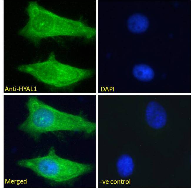 HYAL1 Antibody - Hyaluronidase 1 antibody immunofluorescence analysis of paraformaldehyde fixed HeLa cells, permeabilized with 0.15% Triton. Primary incubation 1hr (10ug/ml) followed by Alexa Fluor 488 secondary antibody (2ug/ml), showing cytoplasmic staining. The nuclear stain is DAPI (blue). Negative control: Unimmunized goat IgG (10ug/ml) followed by Alexa Fluor 488 secondary antibody (2ug/ml).
