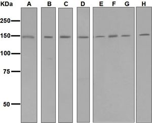 HYOU1 / ORP150 Antibody - Western blot analysis on (A) fetal liver, (B) rat liver, (C) rat pancreas, (D) 293T, (E) MCF-7, (F) MDA-MB-435S, (G) SH-SY5Y, and (H) HeLa lysates using anti-GRP170 / ORP150 antibody.