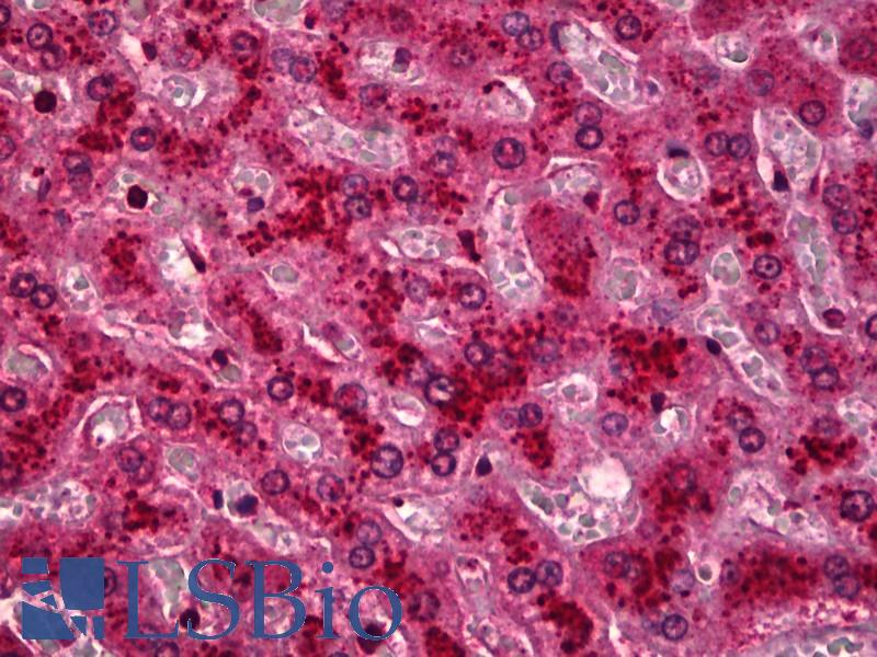 HYOU1 / ORP150 Antibody - Anti-HYOU1 / ORP150 antibody IHC of human liver. Immunohistochemistry of formalin-fixed, paraffin-embedded tissue after heat-induced antigen retrieval. Antibody dilution 1:50.