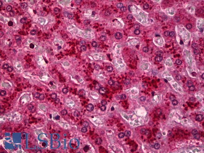 HYOU1 / ORP150 Antibody - Anti-HYOU1 / ORP150 antibody IHC of human liver. Immunohistochemistry of formalin-fixed, paraffin-embedded tissue after heat-induced antigen retrieval. Antibody dilution 1:50.