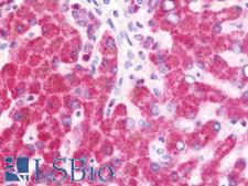 I-309 / CCL1 Antibody - Anti-I-309 / CCL1 antibody IHC staining of human liver. Immunohistochemistry of formalin-fixed, paraffin-embedded tissue after heat-induced antigen retrieval. Antibody concentration 10 ug/ml.